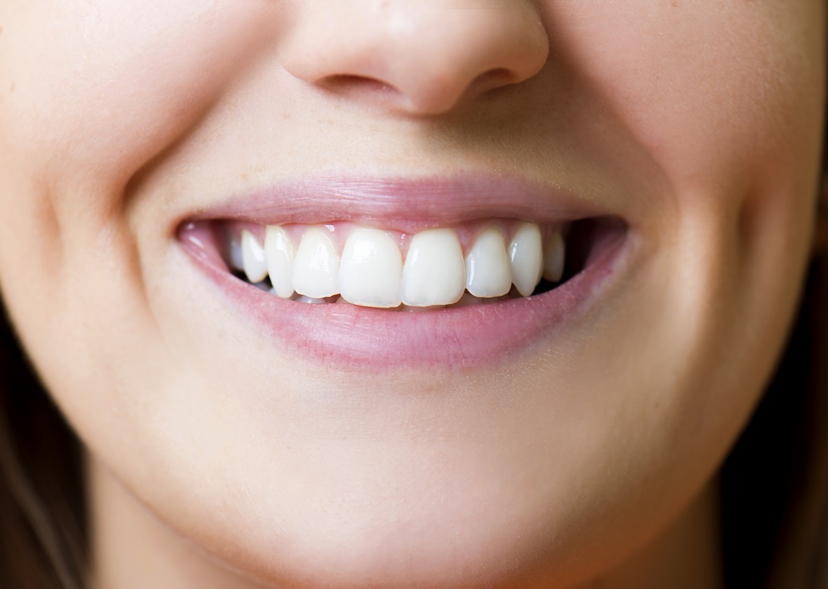 beautiful-girl-is-showing-her-white-teeth-at-dentist